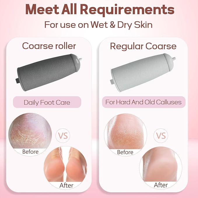 Rechargeable Callus & Dead Skin Remover
