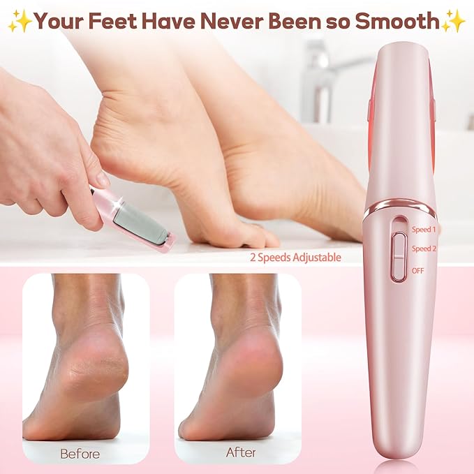 Rechargeable Callus & Dead Skin Remover