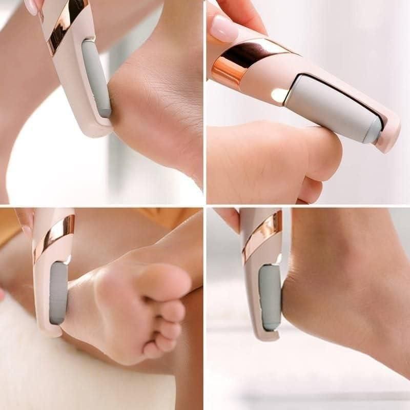 Rechargeable Callus & Dead Skin Remover